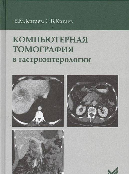Компьютерная томография в гастроэнтерологии | Computed Tomography in Gastroenterology
