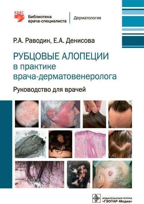 Рубцовые алопеции в практике врача-дерматовенеролога | Cicatricial alopecia in the practice of a dermatovenerologist