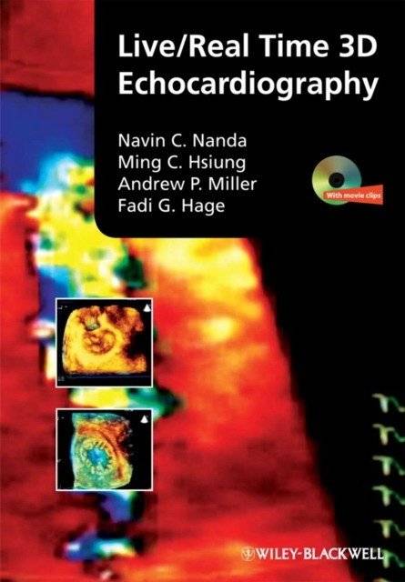 Live/real time 3d echocardiography | Live/Real-Time 3D Echocardiography