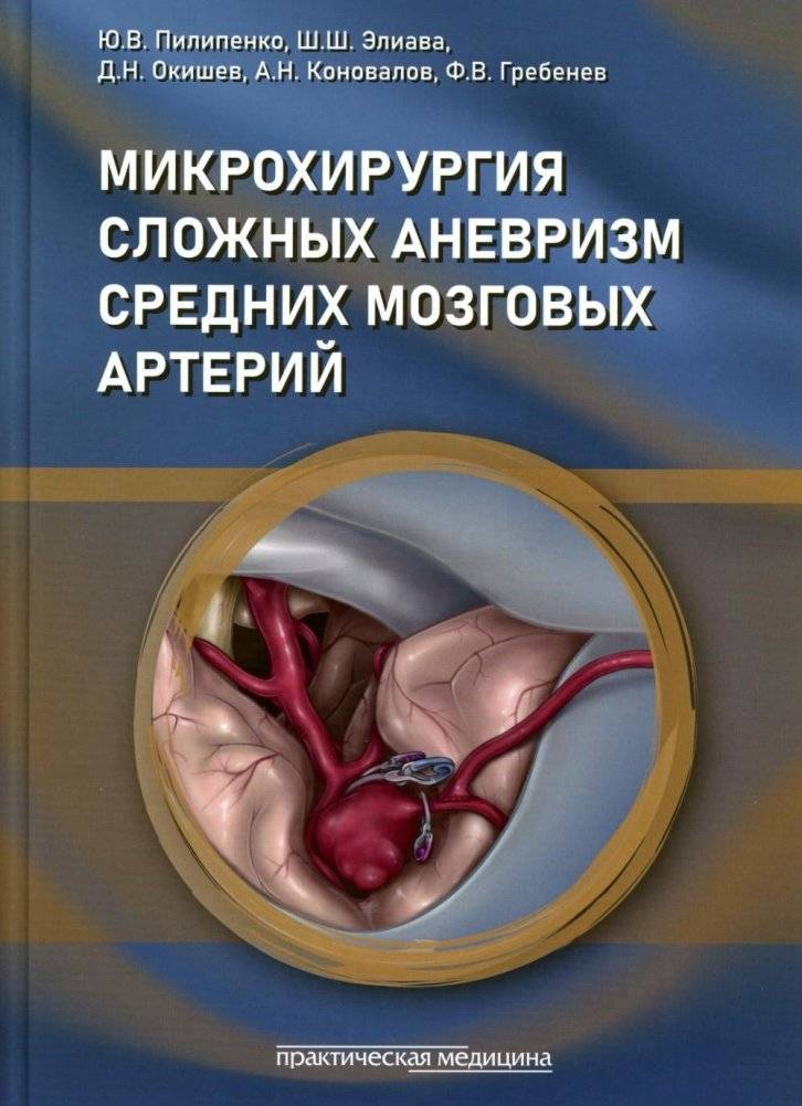 Микрохирургия сложных аневризм средних мозговых артерий: гигантских, фузиформных и частично тромбированных | Microsurgery of Complex Middle Cerebral Artery Aneurysms: Giant, Fusiform, and Partially Thrombosed
