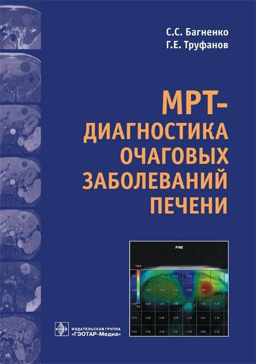 МРТ-диагностика очаговых заболеваний печени | MRI diagnostics of focal liver diseases