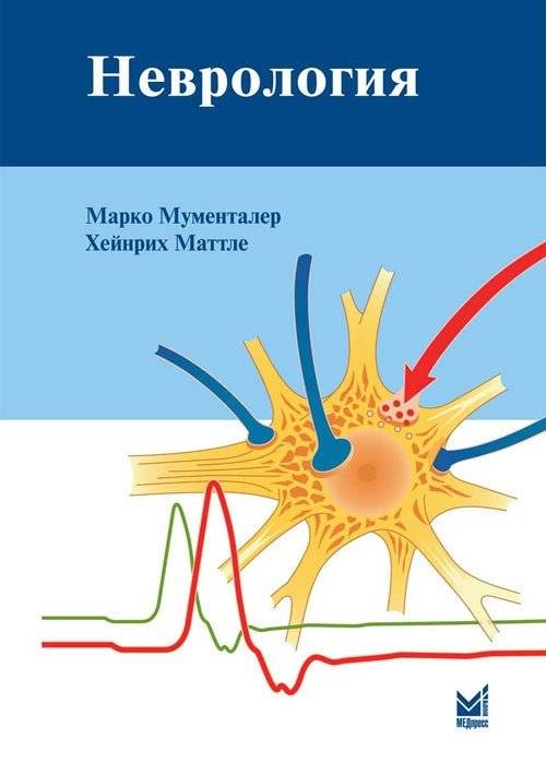 Неврология | Neurology