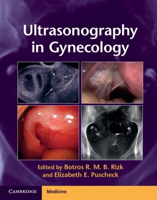 Ультразвуковое исследование в гинекологии | Ultrasonography in Gynecology