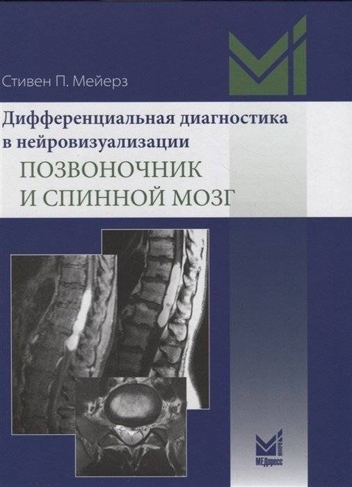 Дифференциальная диагностика в нейровизуализации. Позвоночник и спинной мозг | Differential Diagnosis in Neuroimaging: Spine and Spinal Cord