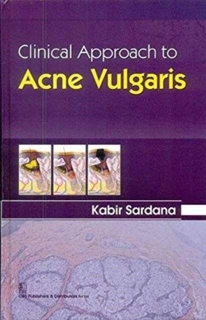 Клинический подход к вульгарным угрям | Clinical Approach to Acne Vulgaris