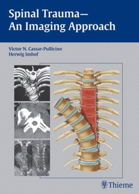 Spinal Trauma - An Imaging Approach | Spinal Trauma: An Imaging Approach