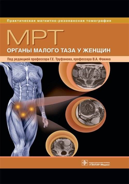 МРТ. Органы малого таза у женщин | MRI of the female pelvic organs
