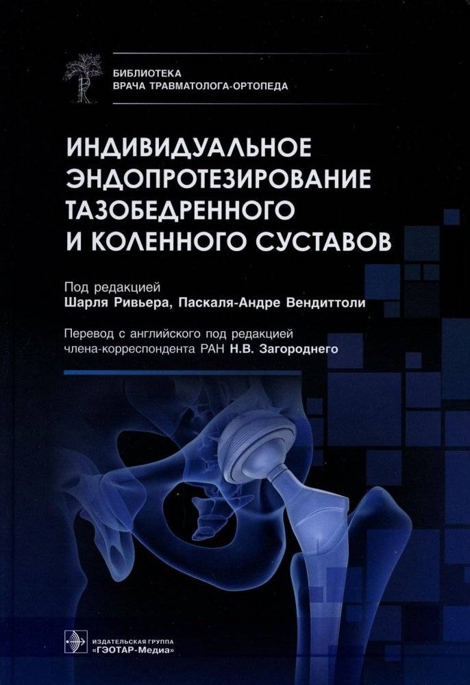 Индивидуальное эндопротезирование тазобедренного и коленного суставов | Custom Hip and Knee Arthroplasty