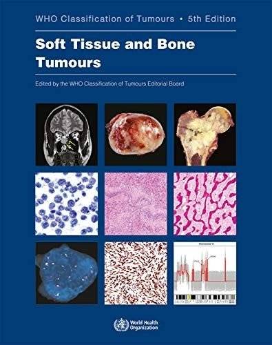 Soft Tissue and Bone Tumours | Soft Tissue and Bone Tumours