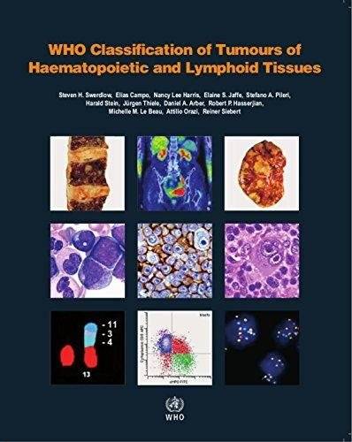 WHO Classification of Tumours of Haematopoietic and Lymphoid Tissues | WHO Classification of Tumours of Haematopoietic and Lymphoid Tissues