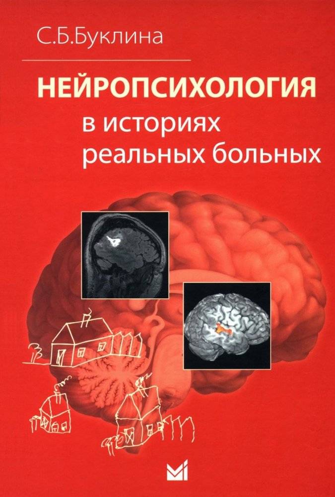 Нейропсихология в историях реальных больных | Neuropsychology in Real Patient Cases