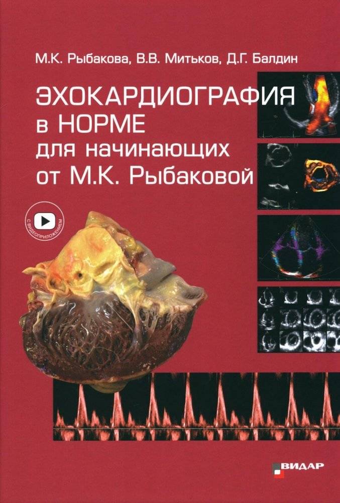 Эхокардиография в норме для начинающих от М.К. Рыбаковой | Echocardiography Norms for Beginners by M.K. Rybakova