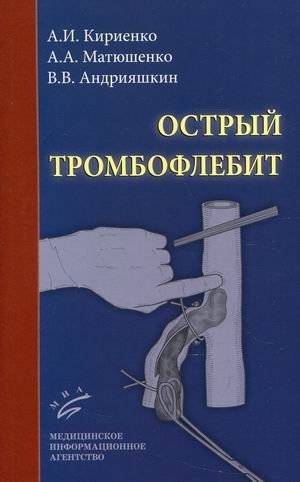 Острый тромбофлебит | Acute Thrombophlebitis