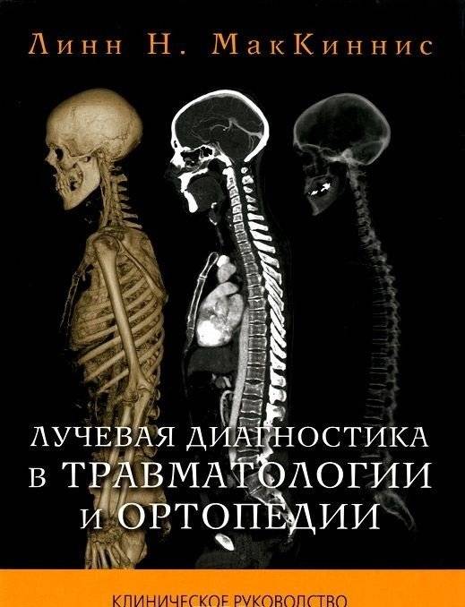 Лучевая диагностика в травматологии и ортопедии. Клиническое руководство | Radiological Diagnostics in Traumatology and Orthopedics: A Clinical Guide