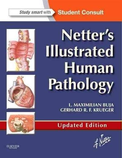 Иллюстрированная патология человека Неттера | Netter's Illustrated Human Pathology