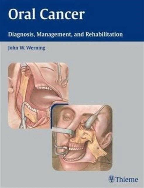 Oral Cancer | Oral Cancer