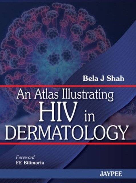 An Atlas Illustrating HIV in Dermatology | An Atlas Illustrating HIV in Dermatology