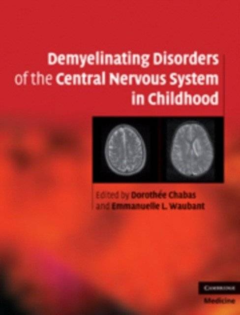 Demyelinating Disorders of the Central Nervous System in Childhood | Demyelinating Disorders of the Central Nervous System in Childhood