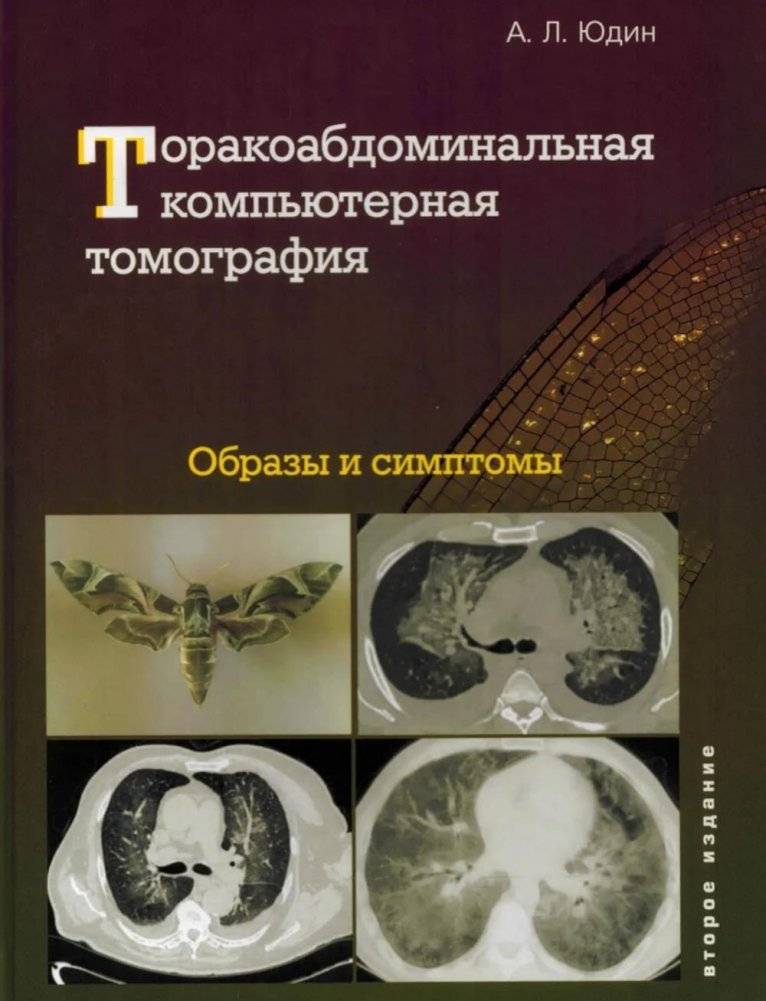 Торакоабдоминальная компьютерная томография. Образы и симптомы | Thoracoabdominal CT: Images and Symptoms