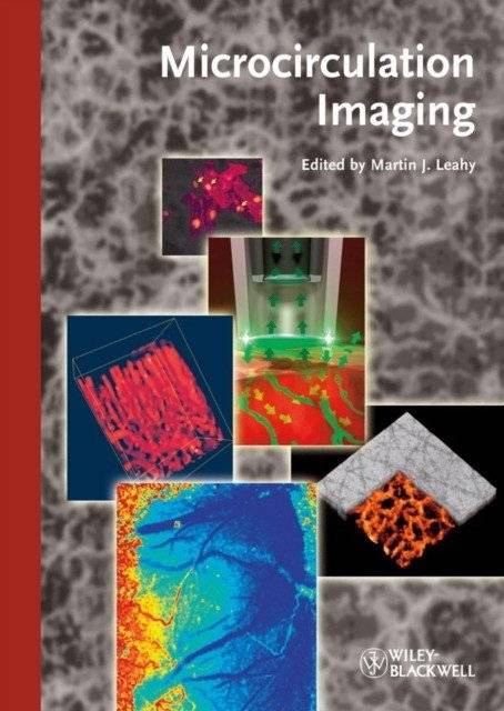 Микроциркуляция: визуализация | Microcirculation Imaging
