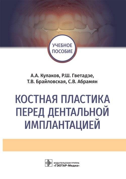 Костная пластика перед дентальной имплантацией | Bone Grafting Before Dental Implantation