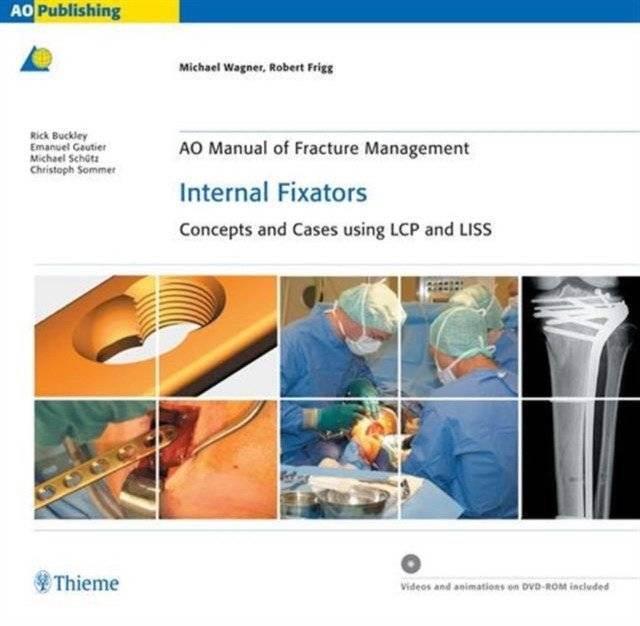 AO Manual of Fracture Management: Internal Fixators - Concepts and Cases using LCP/LISS | AO Manual of Fracture Management: Internal Fixators - Concepts and Cases using LCP/LISS
