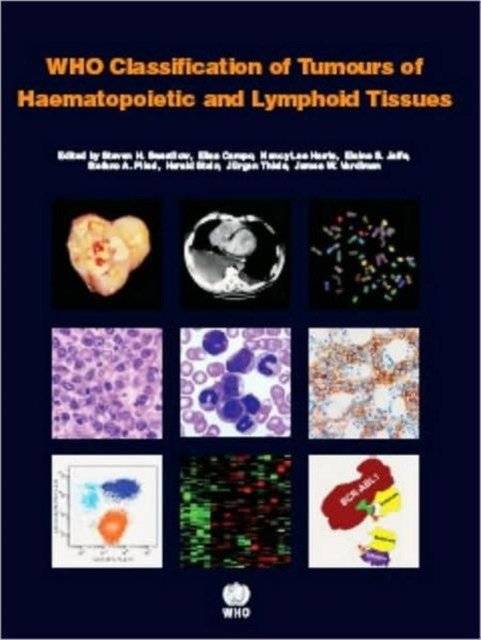 WHO Classification of Tumours of Haematopoietic and Lymphoid Tissues | WHO Classification of Tumours of Haematopoietic and Lymphoid Tissues