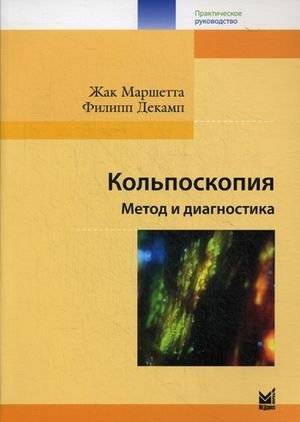 Кольпоскопия. Метод и диагностика | Colposcopy: Method and Diagnostics
