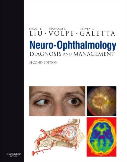 Нейроофтальмология | Neuro-Ophthalmology