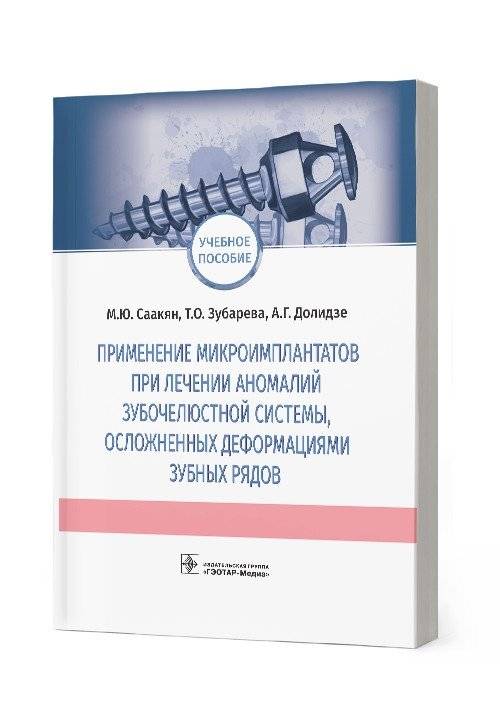 Применение микроимплантатов при лечении аномалий зубочелюстной системы, осложненных деформациями зубных рядов | Application of Microimplants in the Treatment of Dentofacial Anomalies Complicated by Dental Arch Deformations