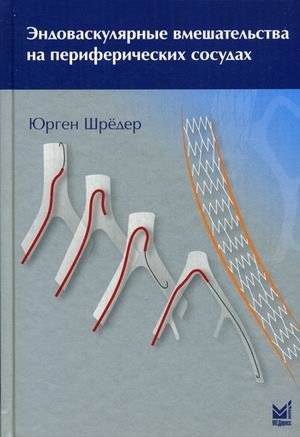 Эндоваскулярные вмешательства на периферических сосудах. Иллюстрированное руководство | Endovascular interventions on peripheral vessels. An illustrated guide