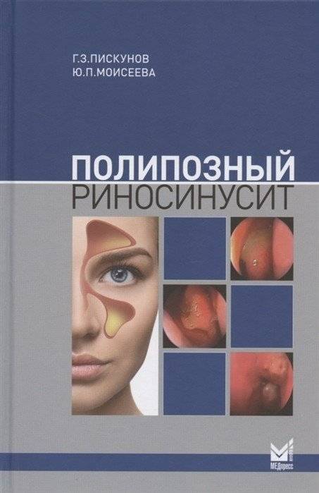 Полипозный риносинусит | Nasal Polyposis and Sinusitis