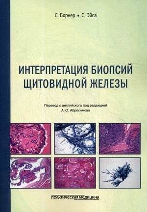 Интерпретация биопсий щитовидной железы | Interpretation of Thyroid Biopsies