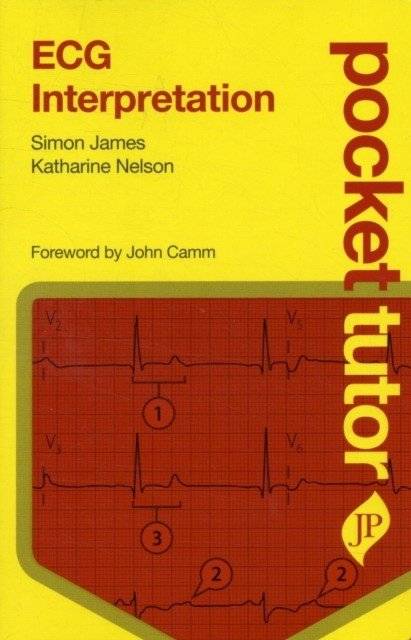 Pocket tutor ecg interpretation | Pocket Tutor ECG Interpretation