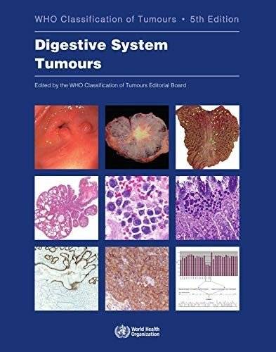 Опухоли пищеварительной системы | Digestive system tumours