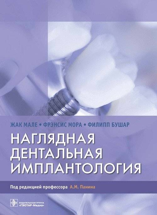 Наглядная дентальная имплантология | Visual Dental Implantology
