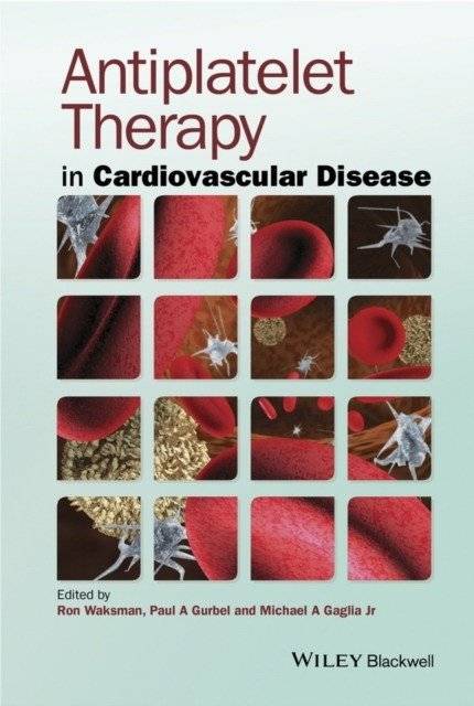 Antiplatelet Therapy | Antiplatelet Therapy