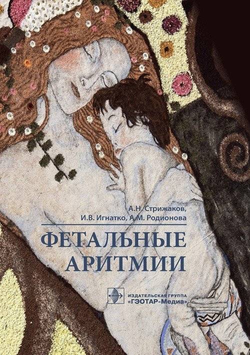 Фетальные аритмии | Fetal Arrhythmias