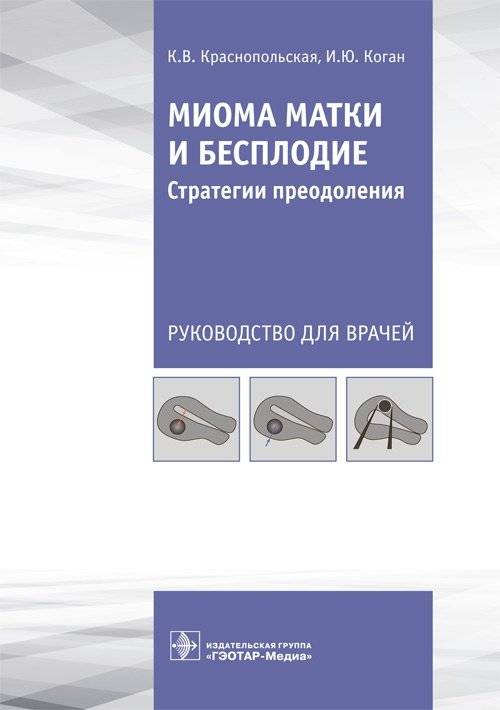 Миома матки и бесплодие. Стратегии преодоления | Uterine Fibroids and Infertility: Strategies for Overcoming