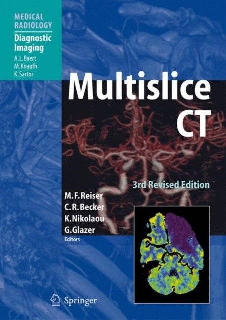 Мультислайсная КТ | Multislice CT