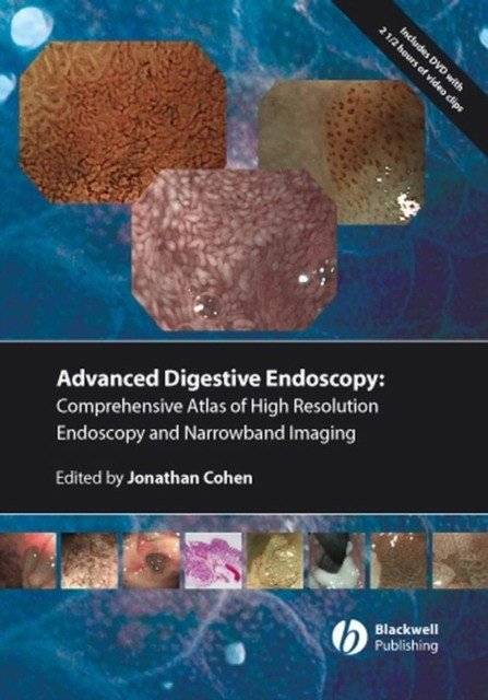 Advanced Digestive Endoscopy - Comprehensive Atlas of High Resolution Endoscopy and Narrowband Imaging | Advanced Digestive Endoscopy: A Comprehensive Atlas of High-Resolution Endoscopy and Narrowband Imaging