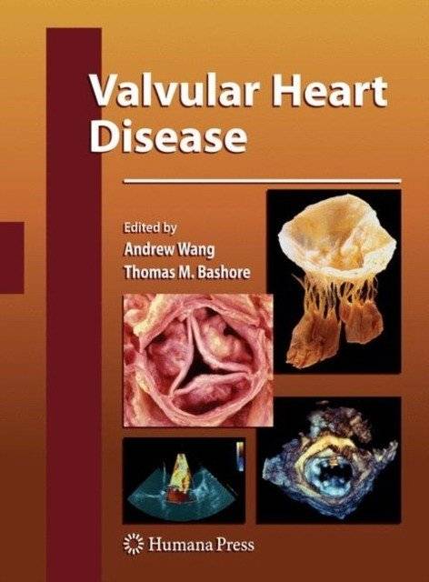 Valvular Heart Disease | Valvular Heart Disease