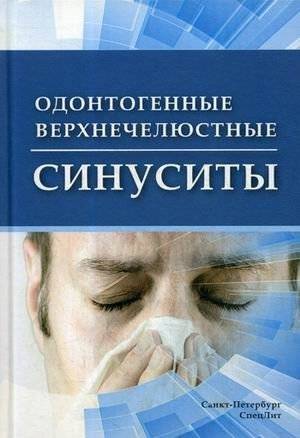 Одонтогенные верхнечелюстные синуситы | Odontogenic Maxillary Sinusitis