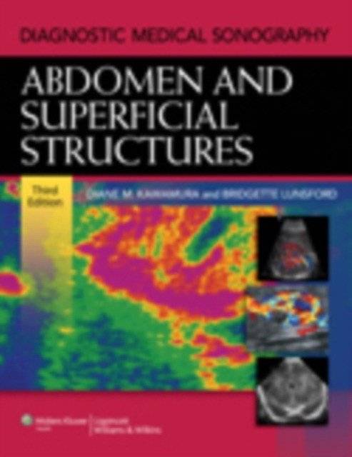 Diagnostic Medical Sonography Abdomen | Diagnostic Medical Sonography: Abdomen