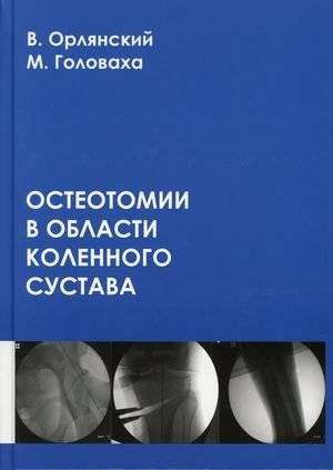 Остеотомии в области коленного сустава | Osteotomies of the Knee Joint