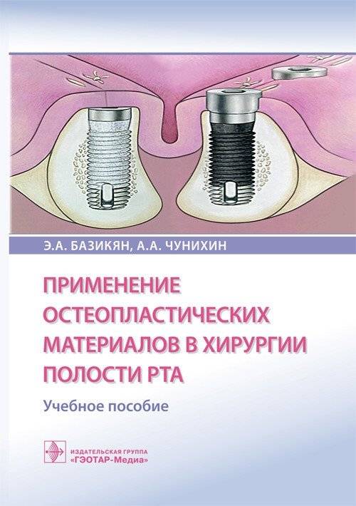 Применение остеопластических материалов в хирургии полости рта | Application of Osteoplastic Materials in Oral Surgery