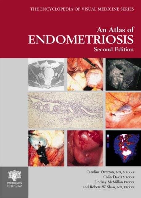 Атлас эндометриоза | Atlas of Endometriosis