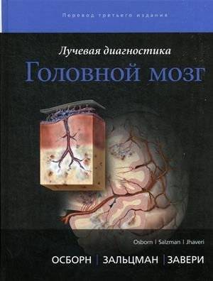 Лучевая диагностика. Головной мозг | Radiological Diagnostics: Brain