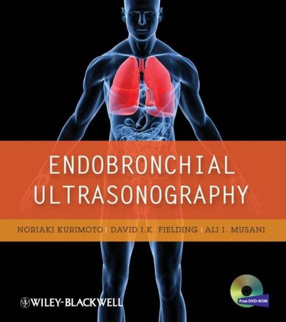 Эндоскопическая ультрасонография | Endobronchial Ultrasonography