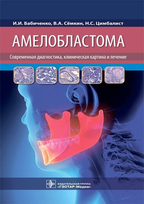 Амелобластома: современная диагностика, клиника и лечение | Ameloblastoma: modern diagnostics, clinical presentation and treatment